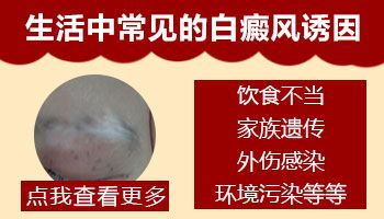 诊断治疗-白癜风患者多运动治疗白癜风好吗